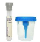 BD 364954 BX/50 KIT URINE CUP 13x75 4.0 C&S