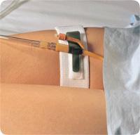 DAL 316 EA/1 FOLEY CATH HOLDER, LEG BAND  2IN X 19.5IN